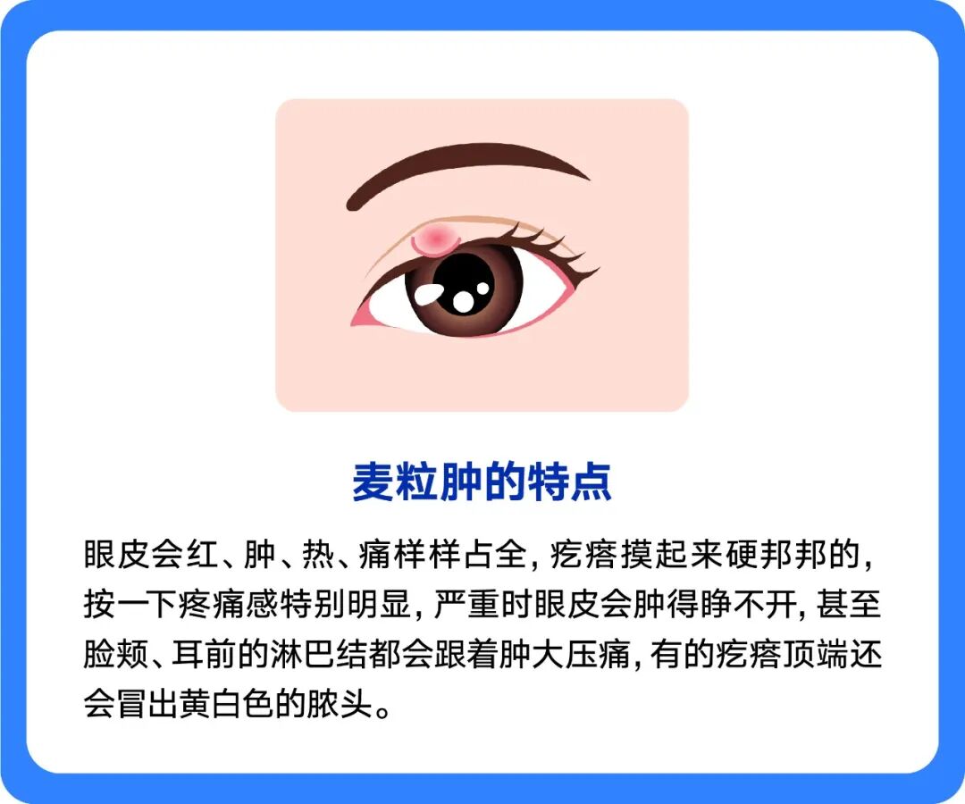 Blog Single